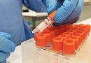 Bahia registra cinco novos casos de Monkeypox